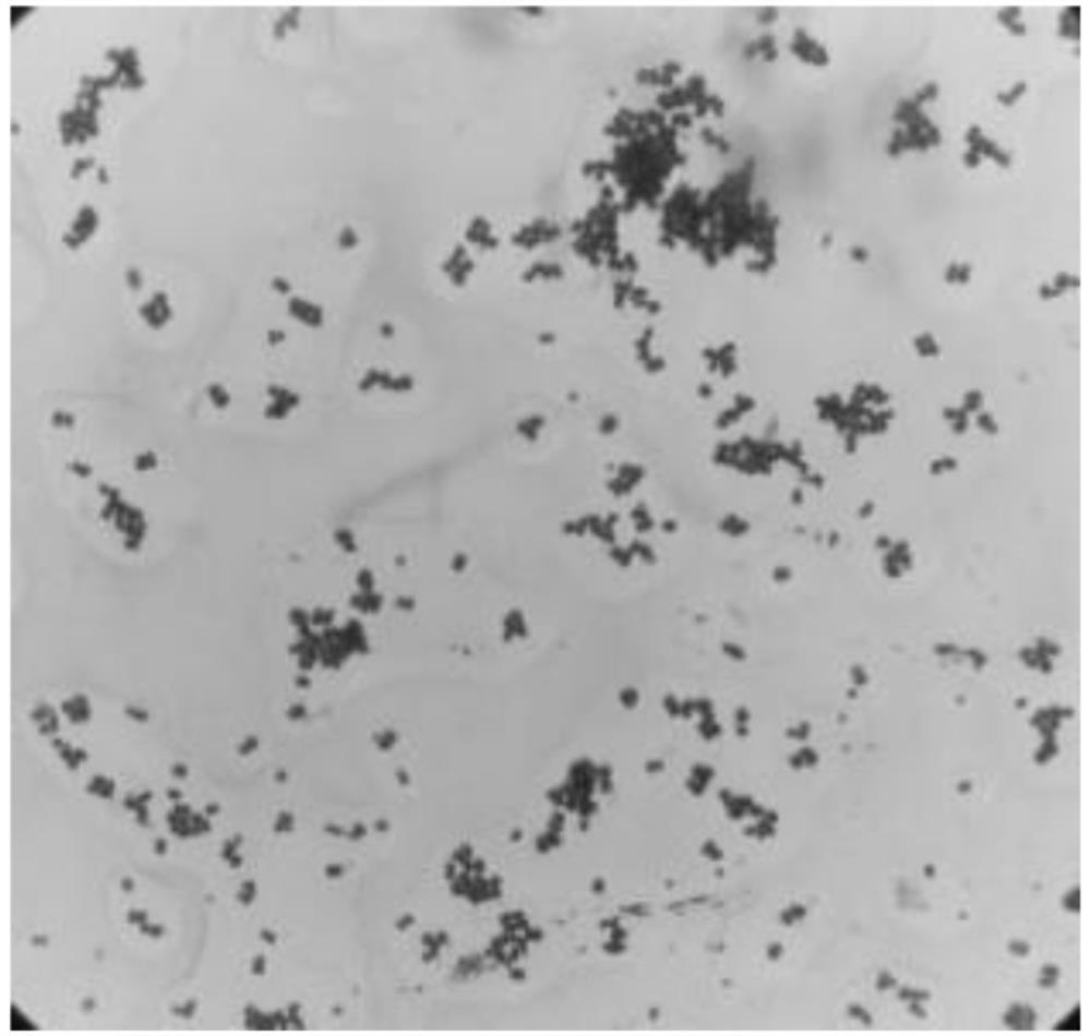 Saccharomyces strain for degrading organic acids and application of saccharomyces strain