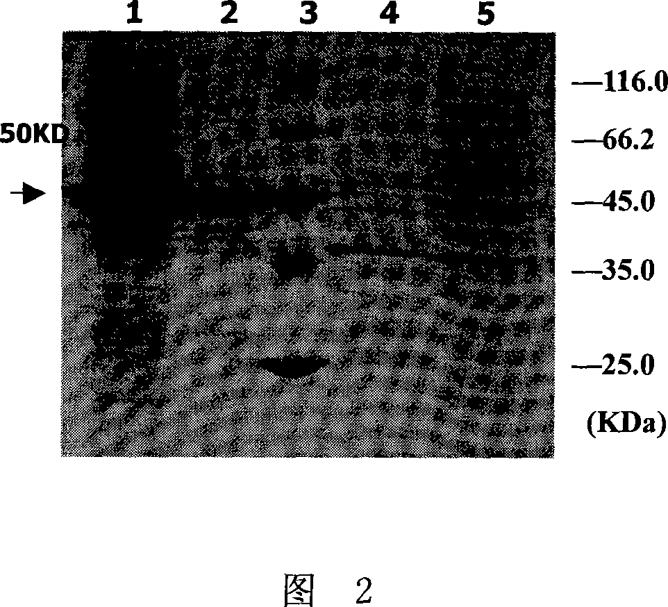 A-type kreotoxin receptor combination region Hc, coding protein and application thereof