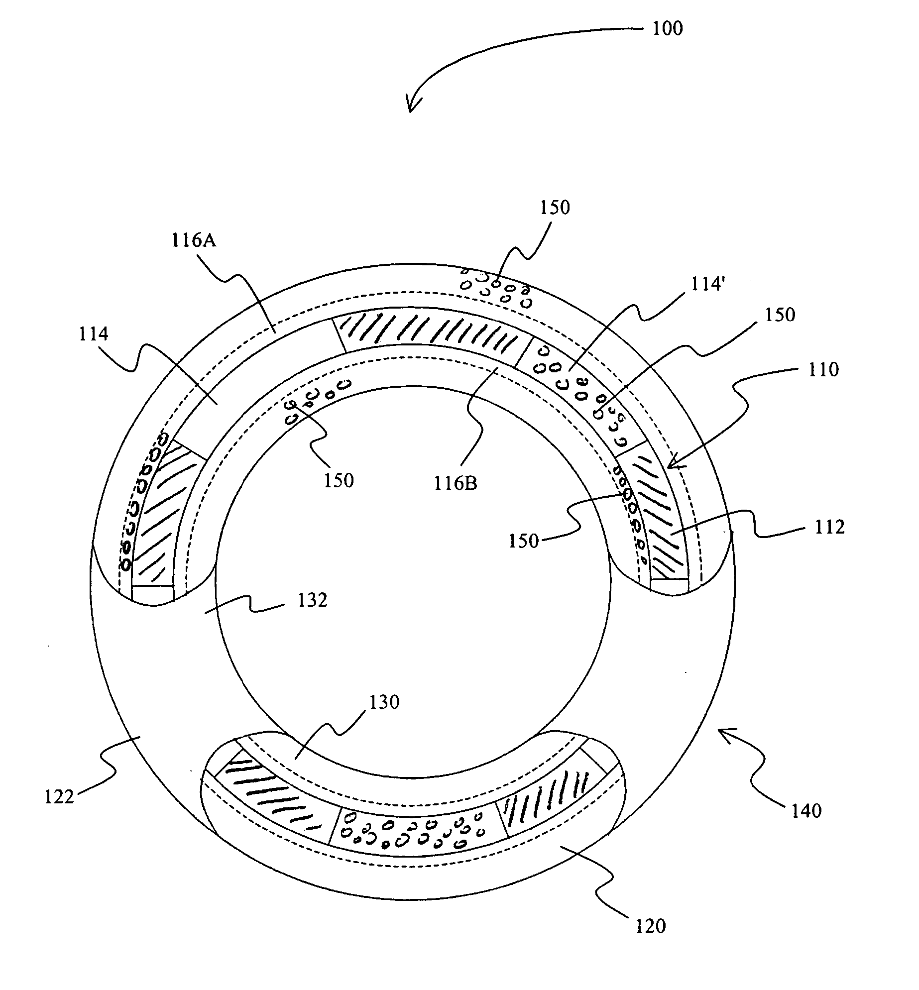 Stent covered by a layer having a layer opening