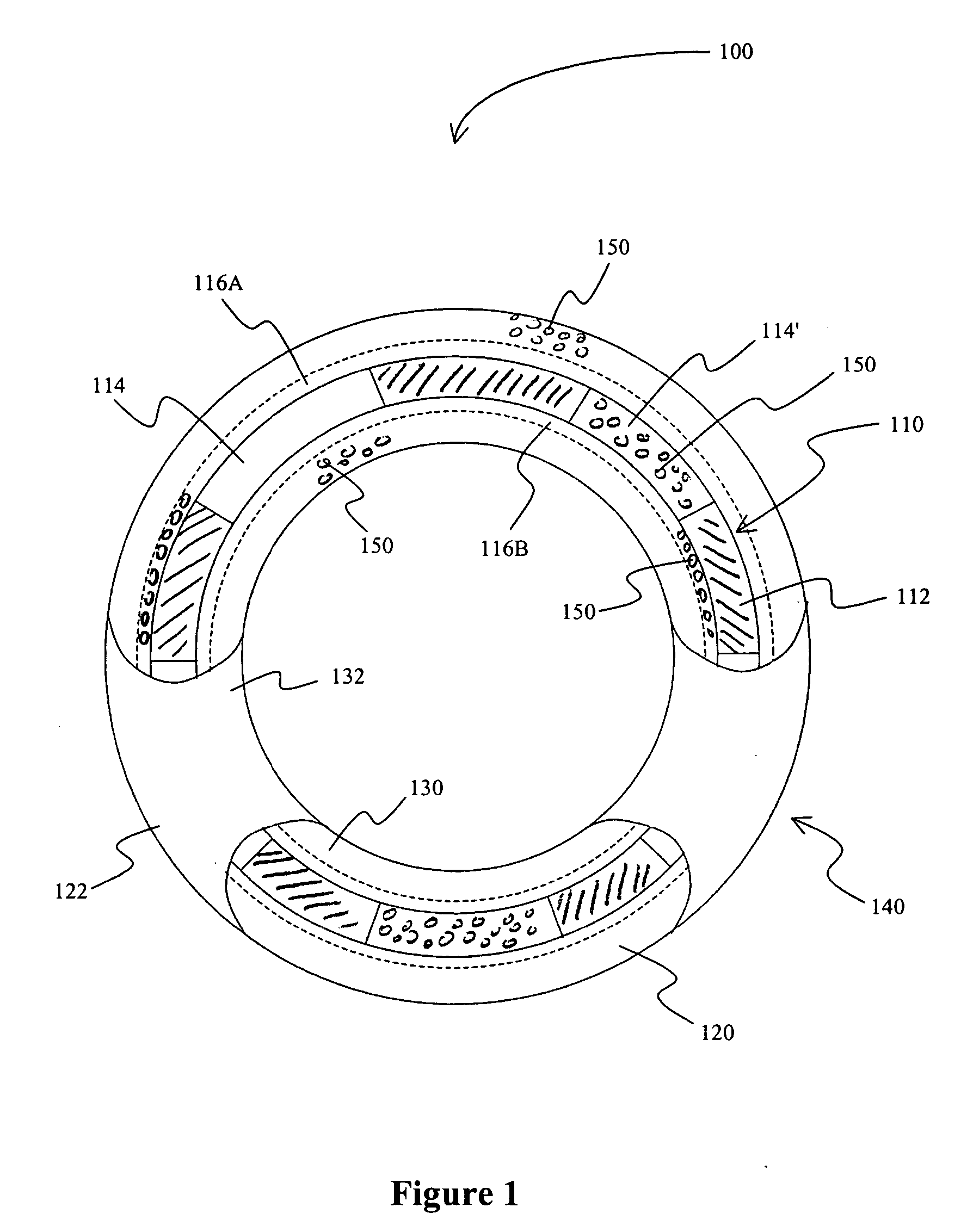 Stent covered by a layer having a layer opening