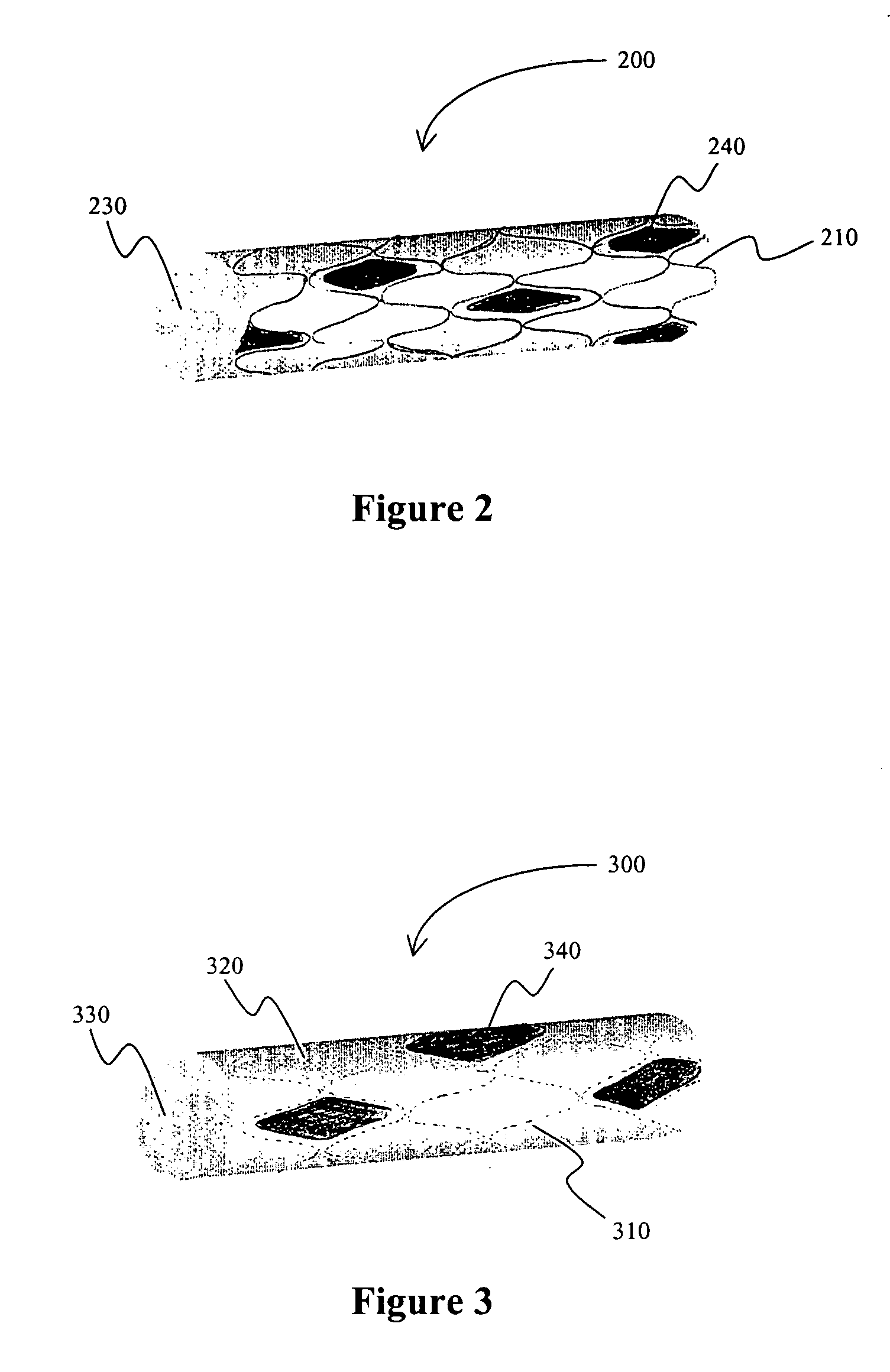 Stent covered by a layer having a layer opening