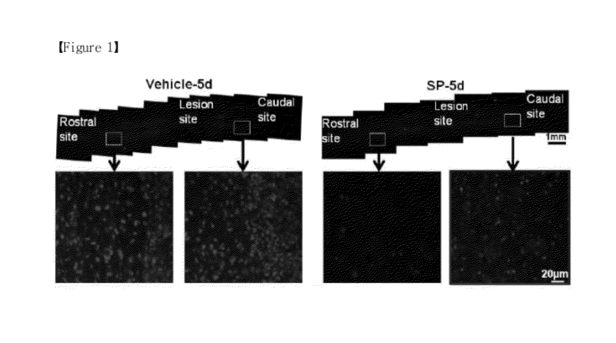 Composition for preventing or treating a spinal cord injury