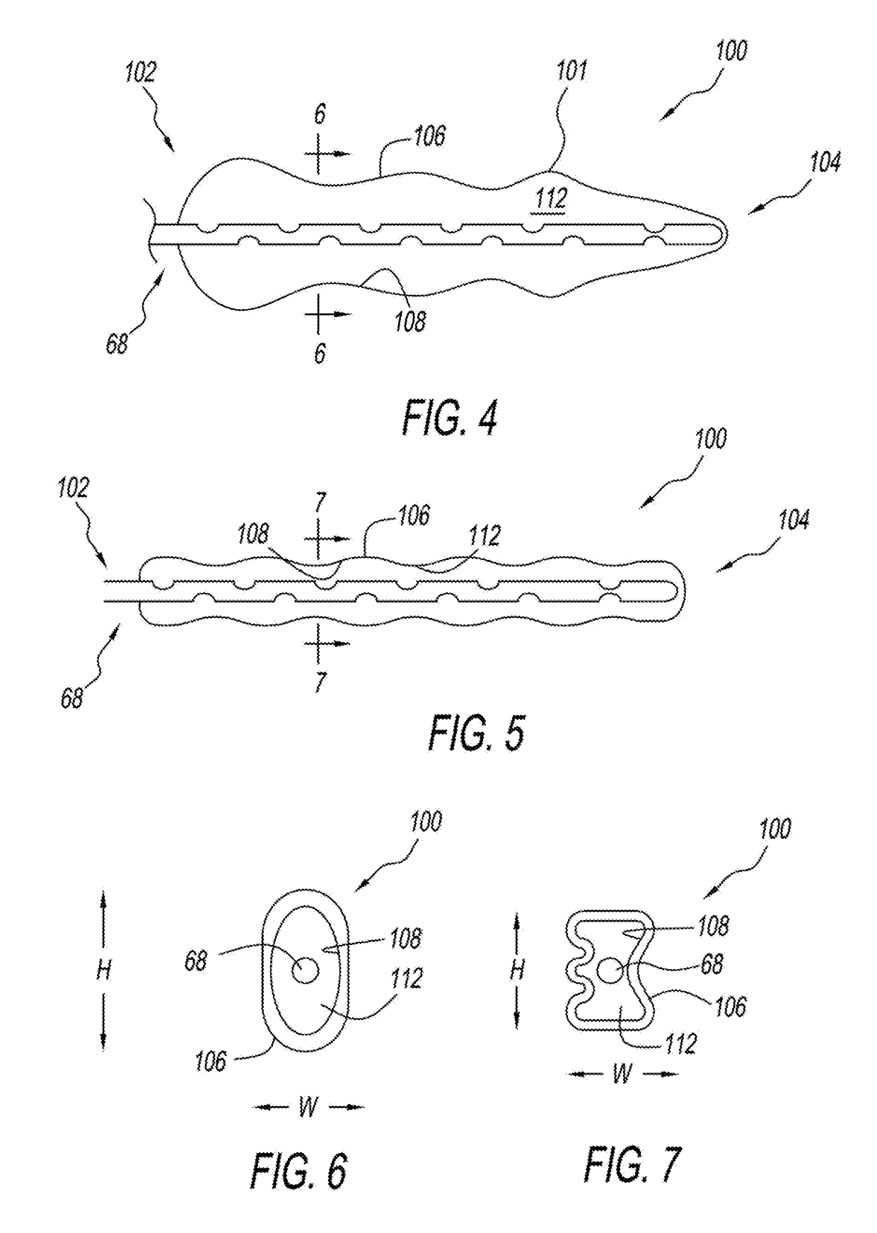 Method and apparatus for treating a malformed eustachian tube