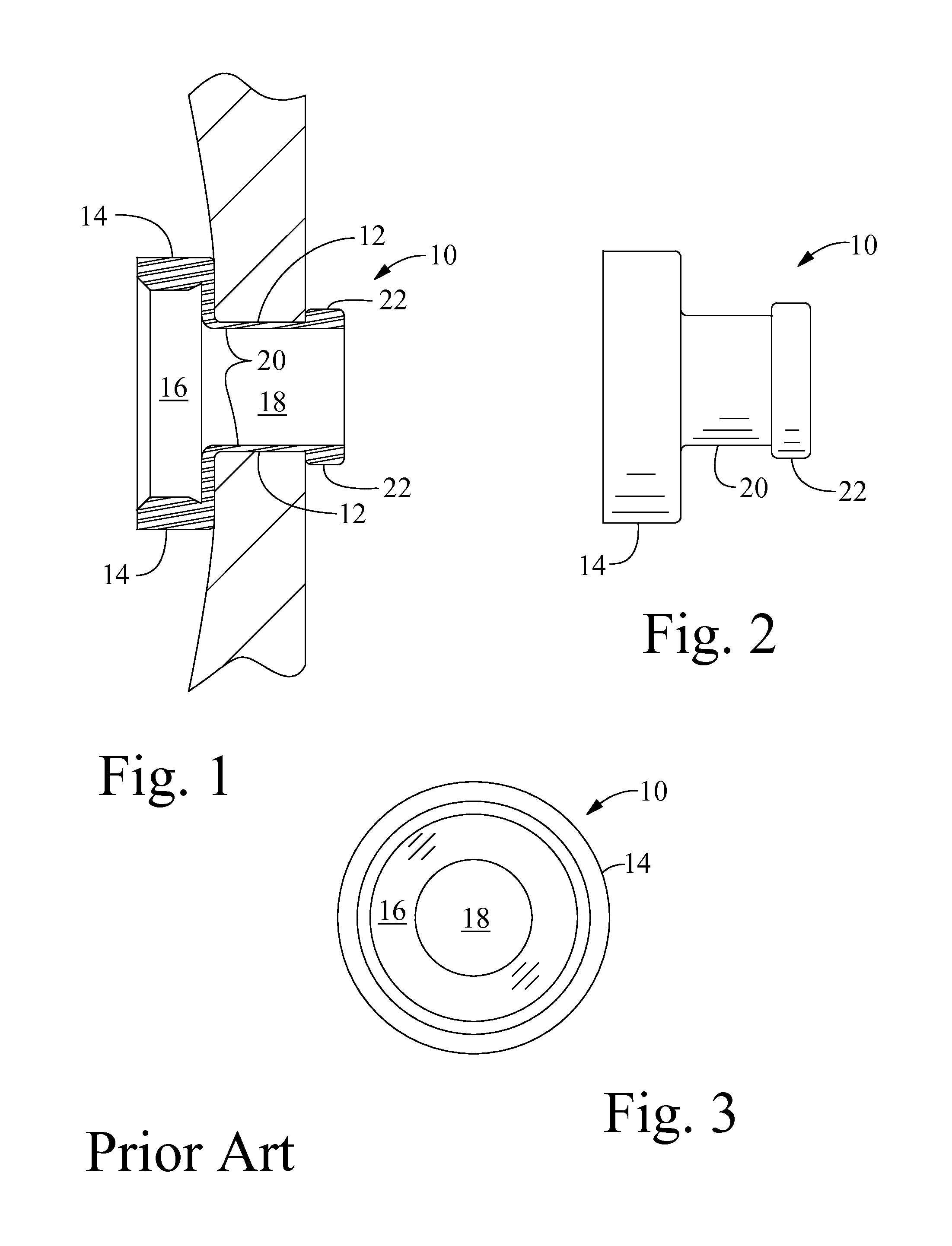 Locking device for an endostomal tracheostoma button