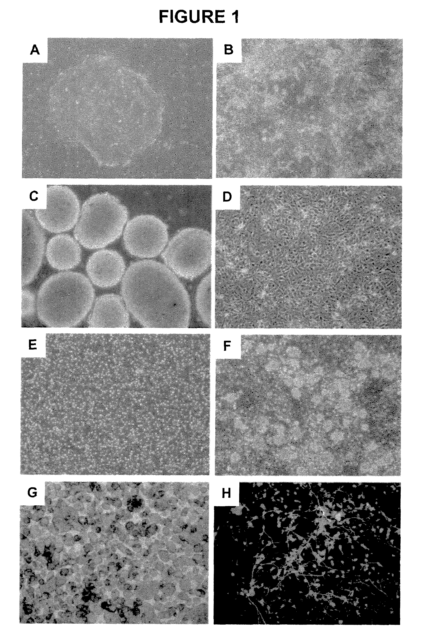 Neuronal progenitor cells and methods of derivation and purification of neuronal progenitor cells from embryonic stem cells