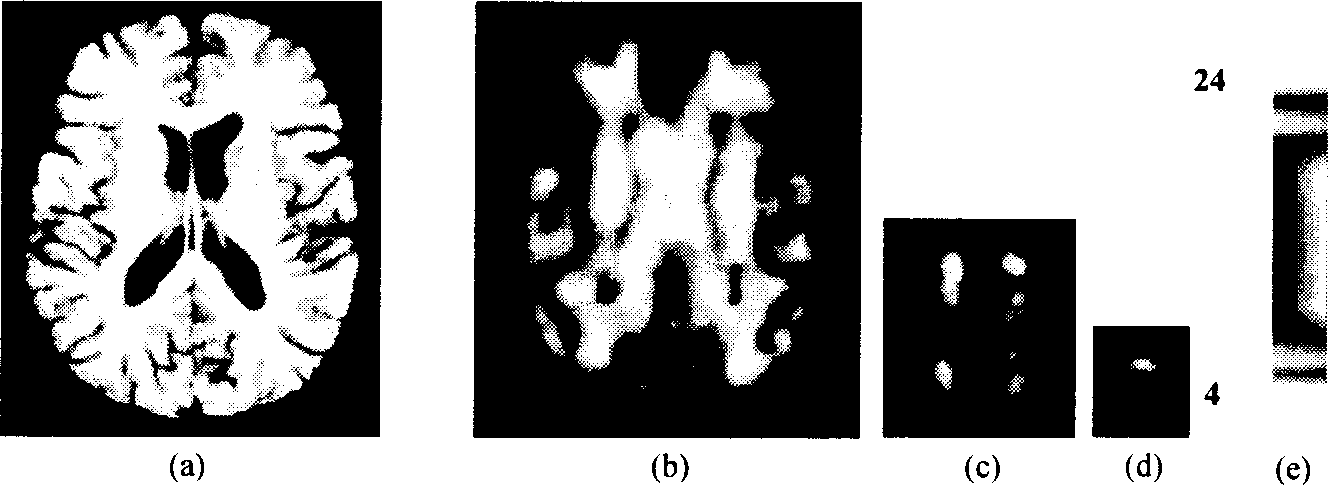 Elastic registration method of stereo MRI brain image based on machine learning