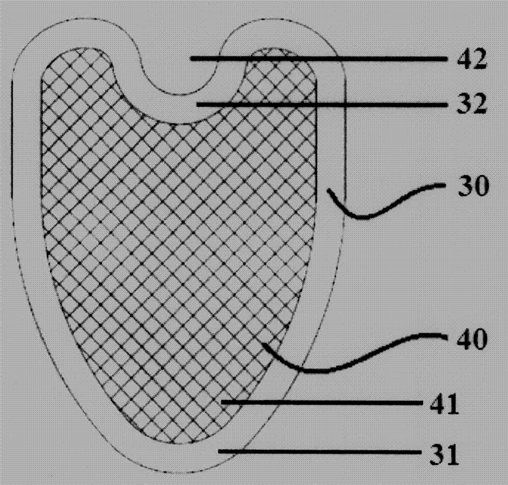 Patch special for esophageal hiatus hernia