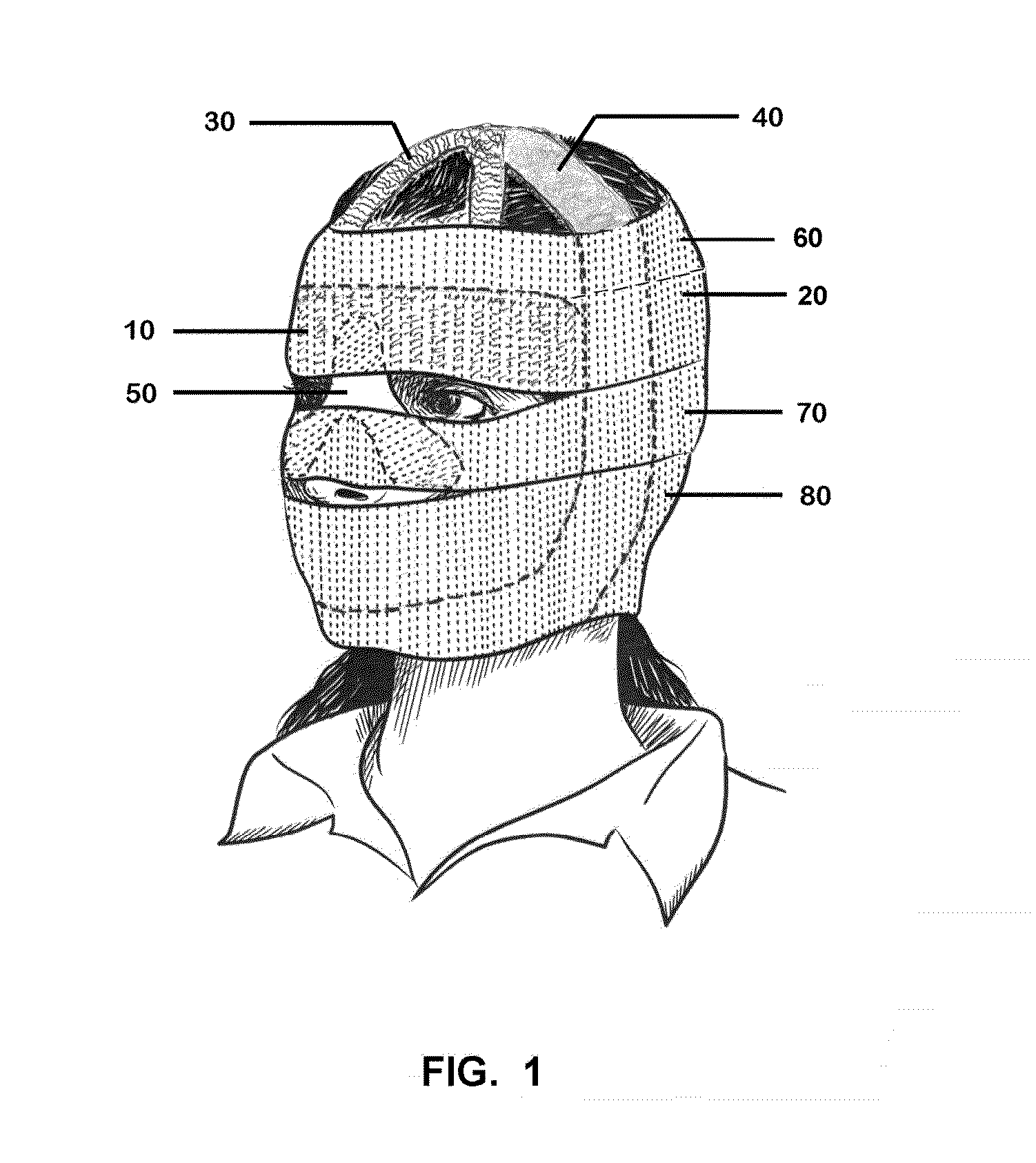 Method and apparatus of face lifting that move facial tissues up and hold