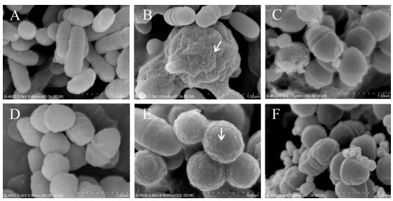 Oral cavity cariogenic bacterium-resisting polypeptide Pm11 and preparation method thereof