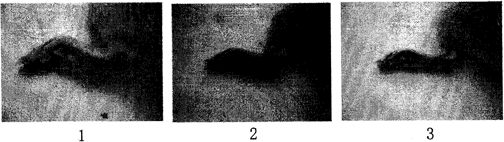 Application of polycation compound in related angiogenesis diseases