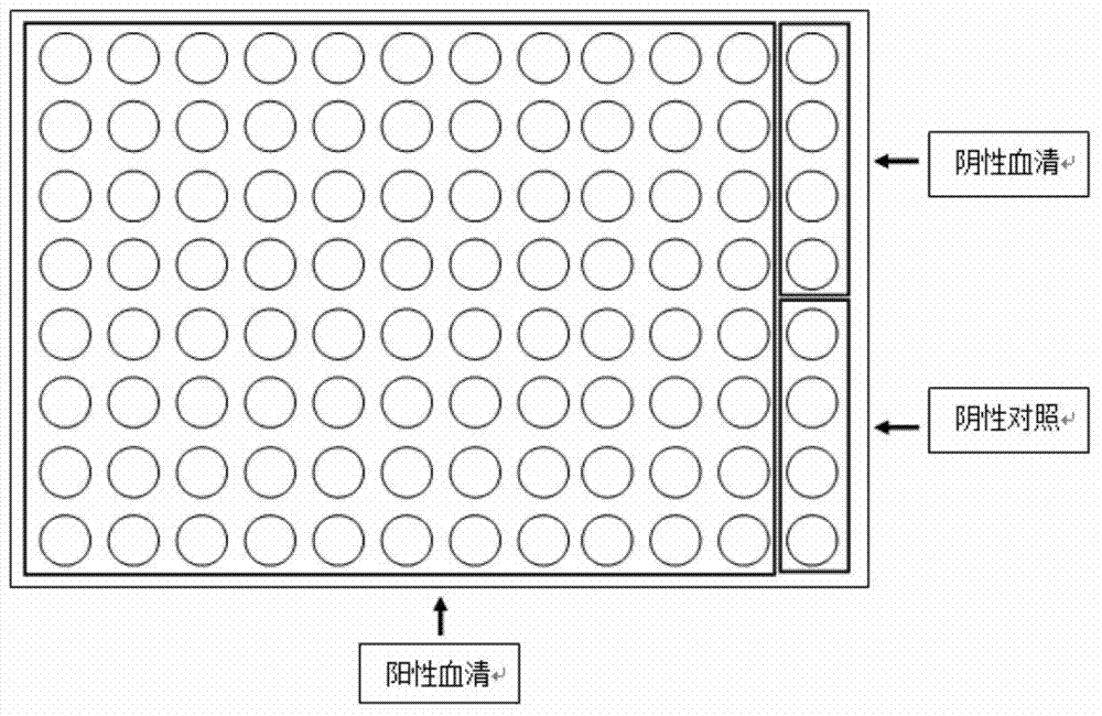 Preparation method and application of protein chip based on serological detection of syphilis