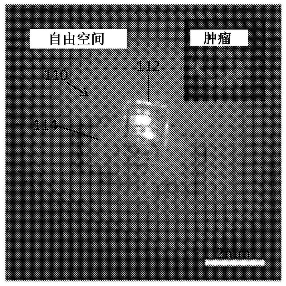 Photodynamic therapy devices, systems and methods