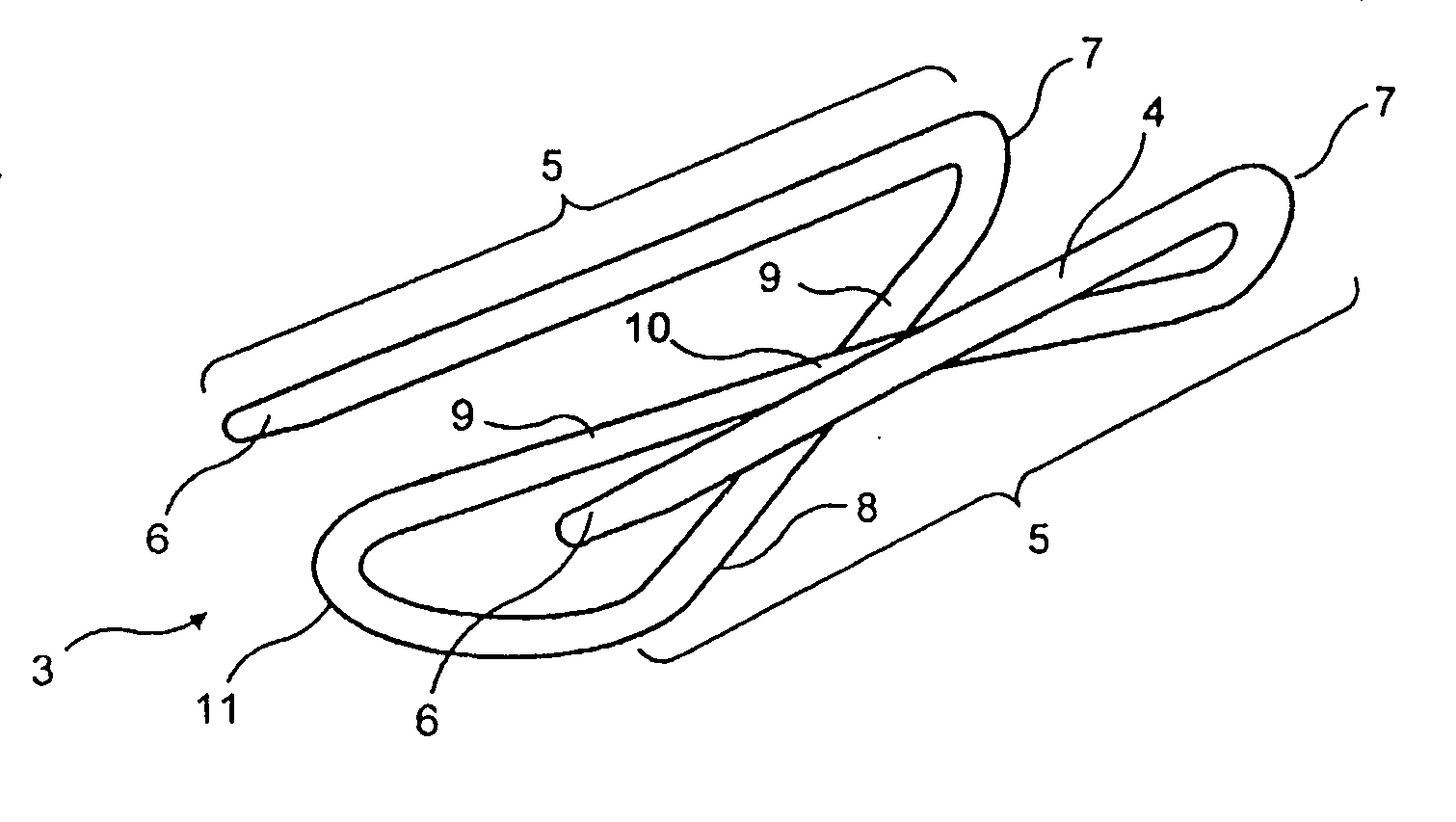 Implant device for applying compression across a fracture site