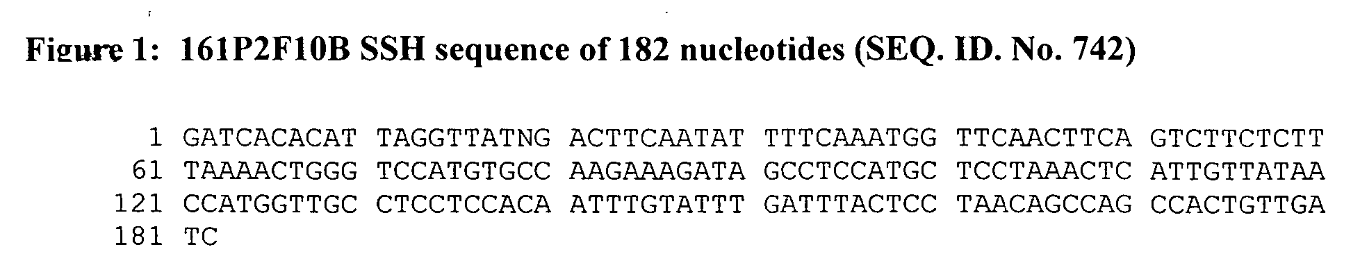 Nucleic acid and corresponding protein entitled 161P2F10B useful in treatment and detection of cancer