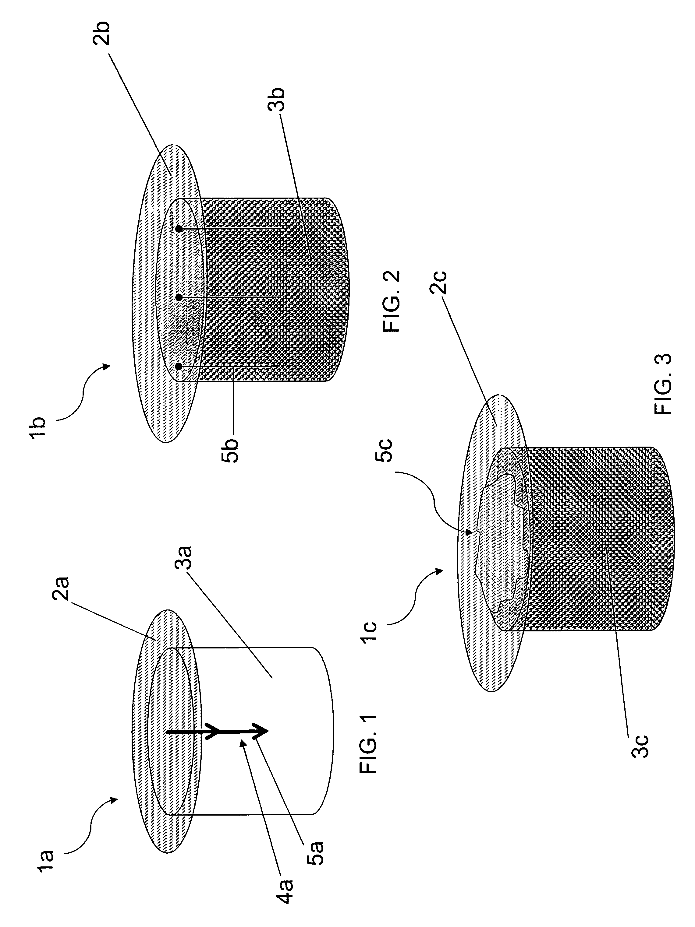 Implant designs and methods of improving cartilage repair