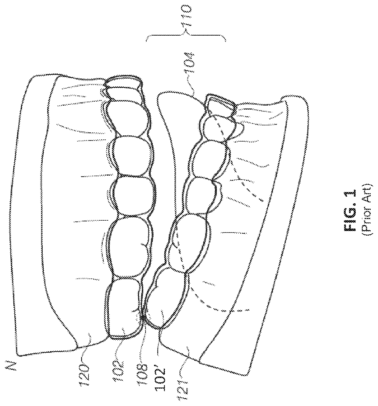 Dental appliance features for speech enhancement