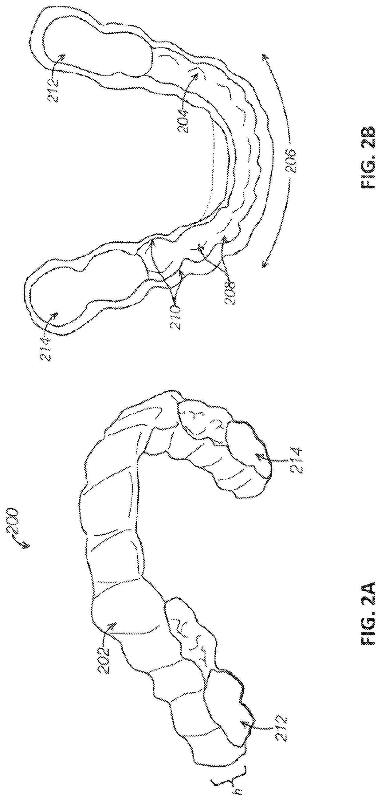 Dental appliance features for speech enhancement