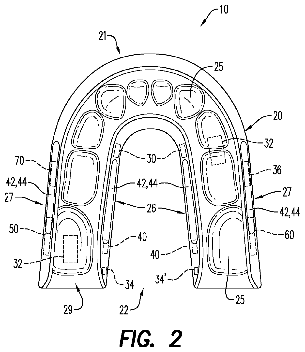 Intra-oral electroencephalography device and method