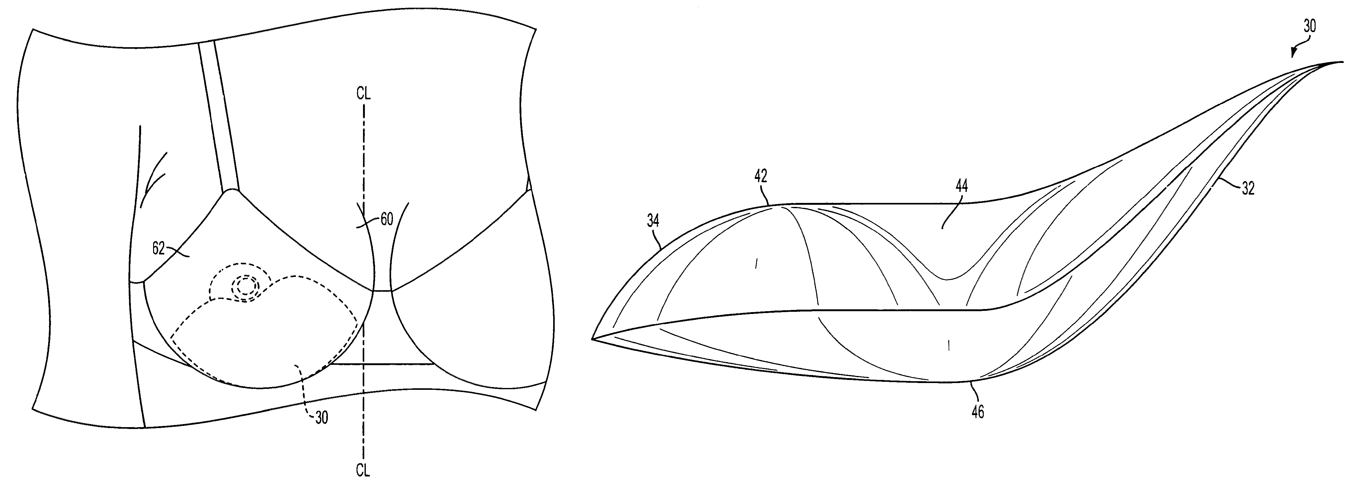 Engineered push up insert