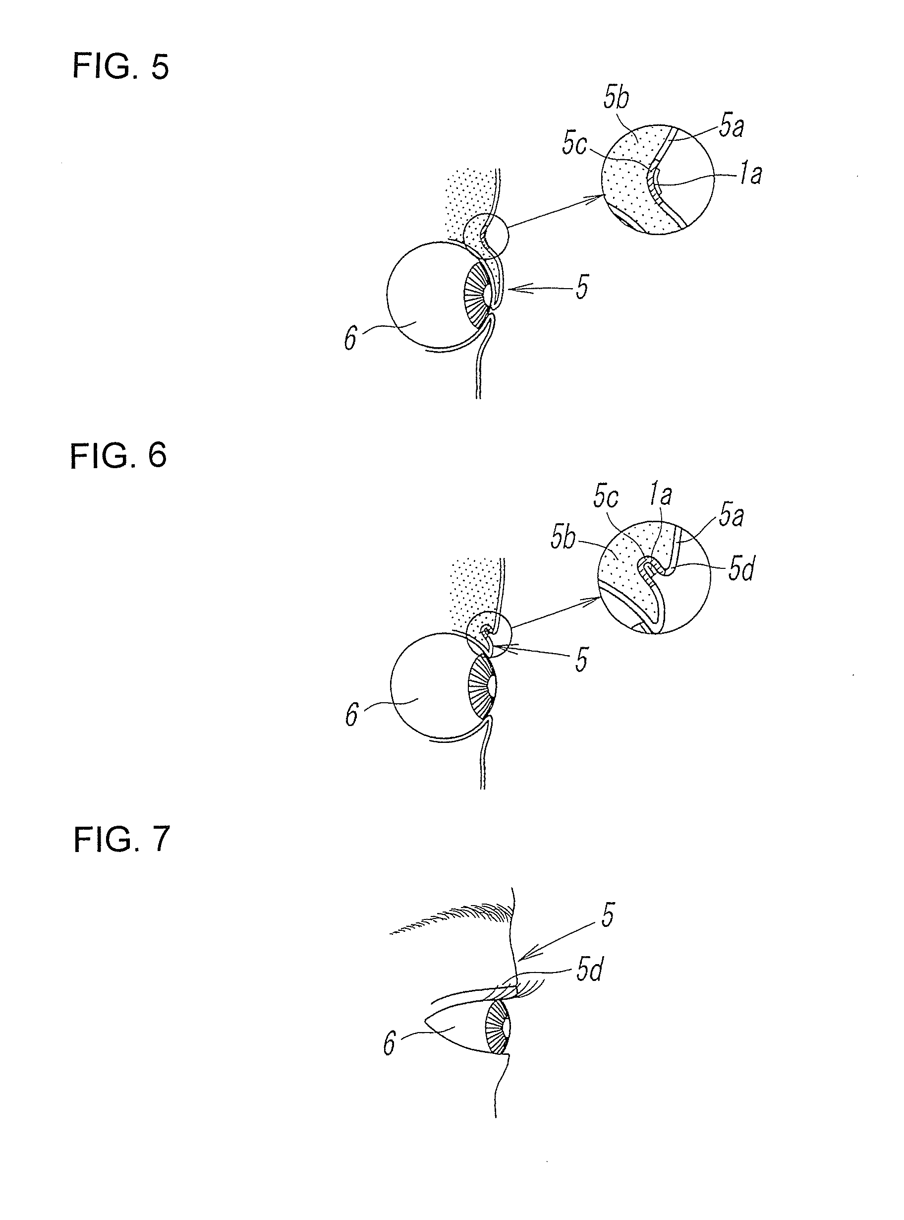 Solution for forming double eyelid and method for forming double eyelid using same