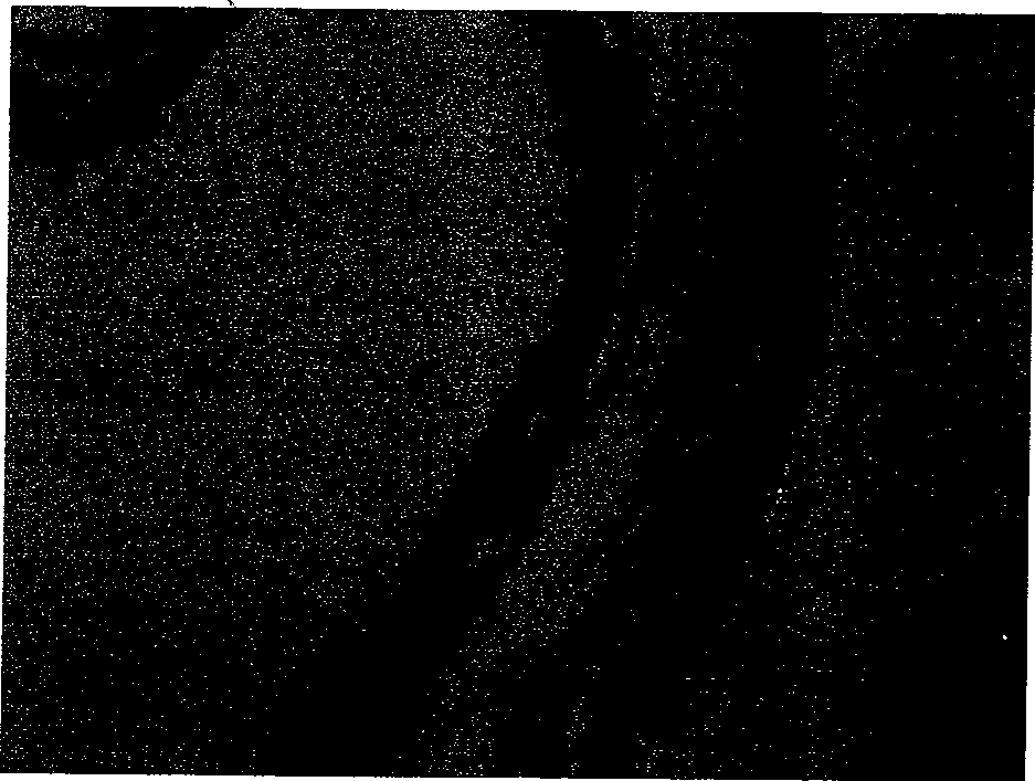 Preparation method of glue adhesion amnion