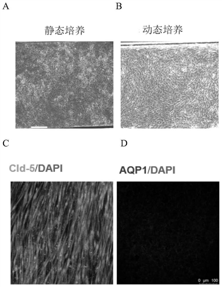 Human blood cerebrospinal fluid barrier model as well as preparation method and application thereof