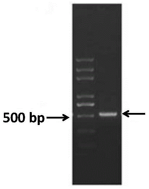 A vaccine that suppresses streptococcal bacteria and/or prevents streptococcal infections