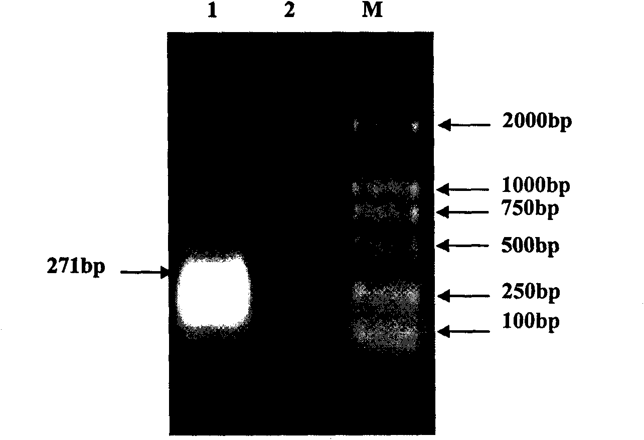 Mycoplasma hyopneumoniae P97R1 gene recombined Pichia pastoris and expression protein