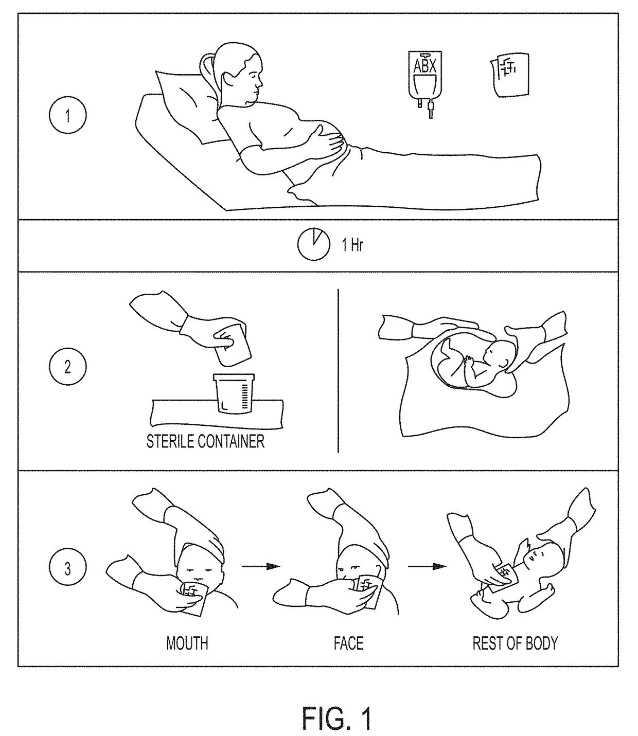 Device and method of restoring microbiota of newborns