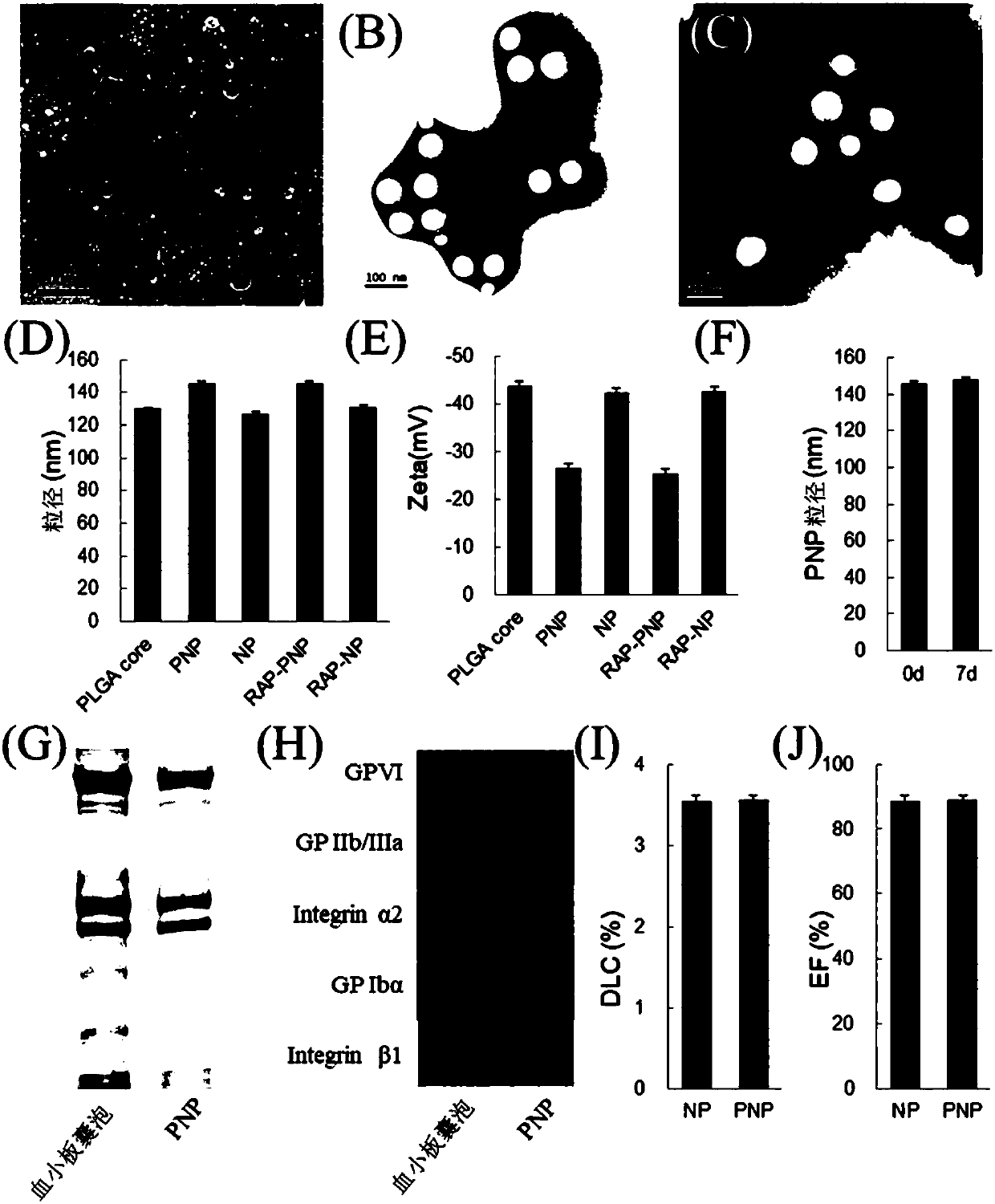 Atherosclerotic plaque-targeting platelet membrane coated rapamycin bionic nano particles and application thereof