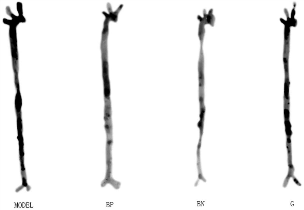 Two-dimensional nanomaterial vascular plaque scavenger, M2 macrophage inducer and cell autophagy modulator