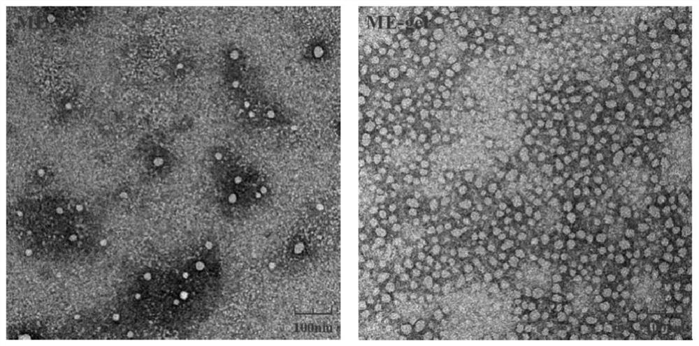 Psoralen/ligustrazine microemulsion and microemulsion gel as well as preparation method and application of psoralen/ligustrazine microemulsion and microemulsion gel