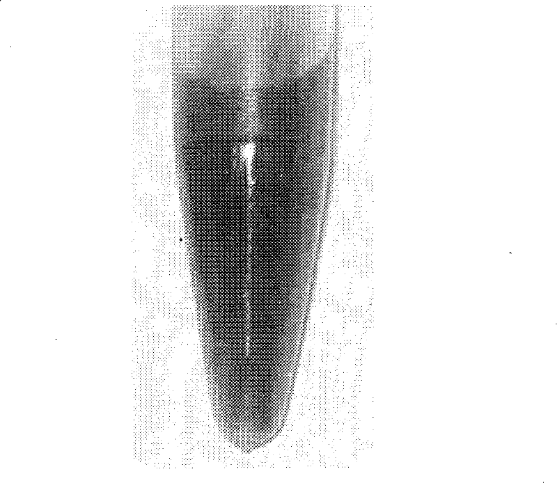 Antibody-gold case iron core magnetic nanometer particle synthetic method for cell recognition and separation