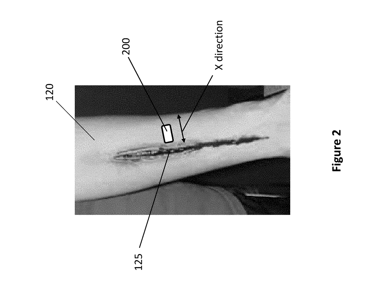 Wearable thermometer patch comprising a temperature sensor array