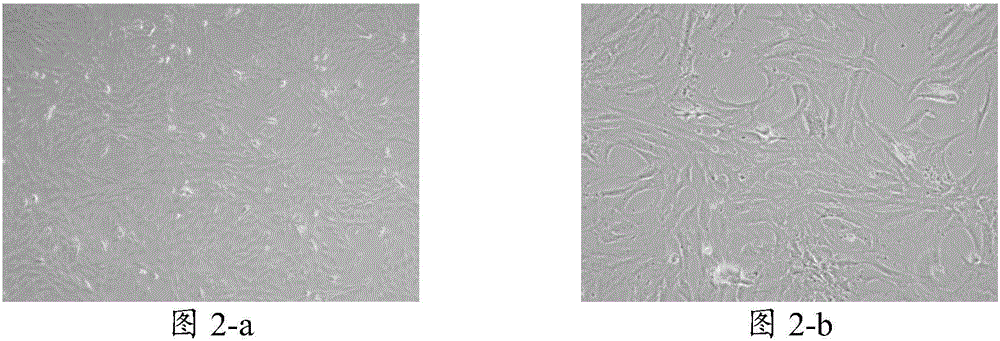 Freezing medium, application thereof and adipose tissue freezing method