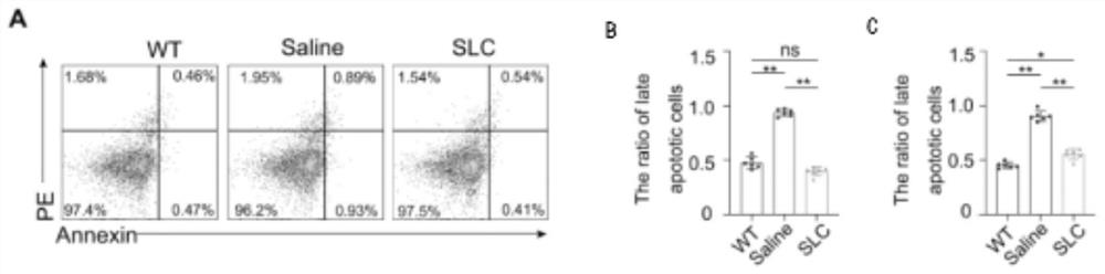 Application of SLC in preparation of product for preventing testis function decline caused by testis injury