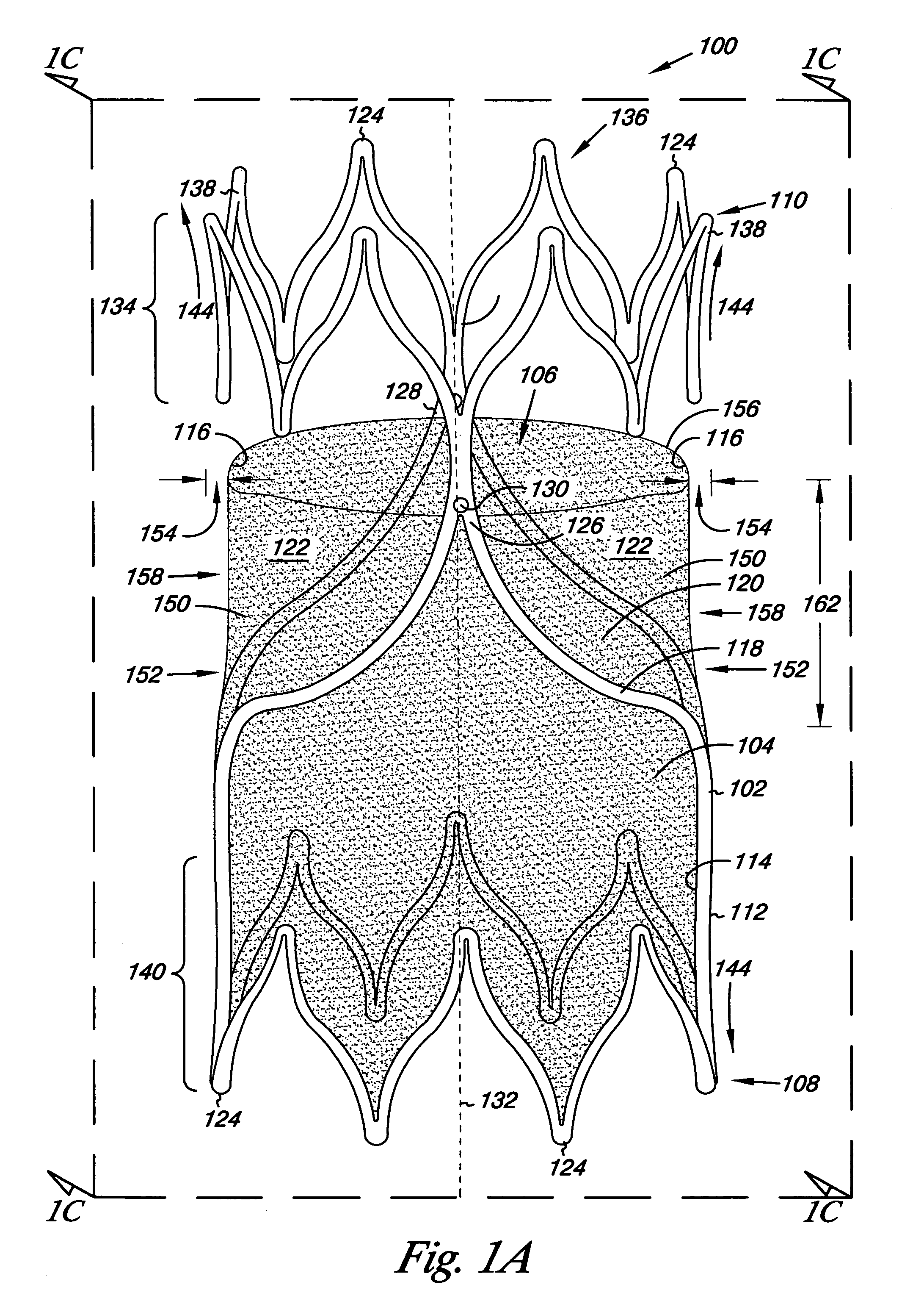 Venous valve, system, and method