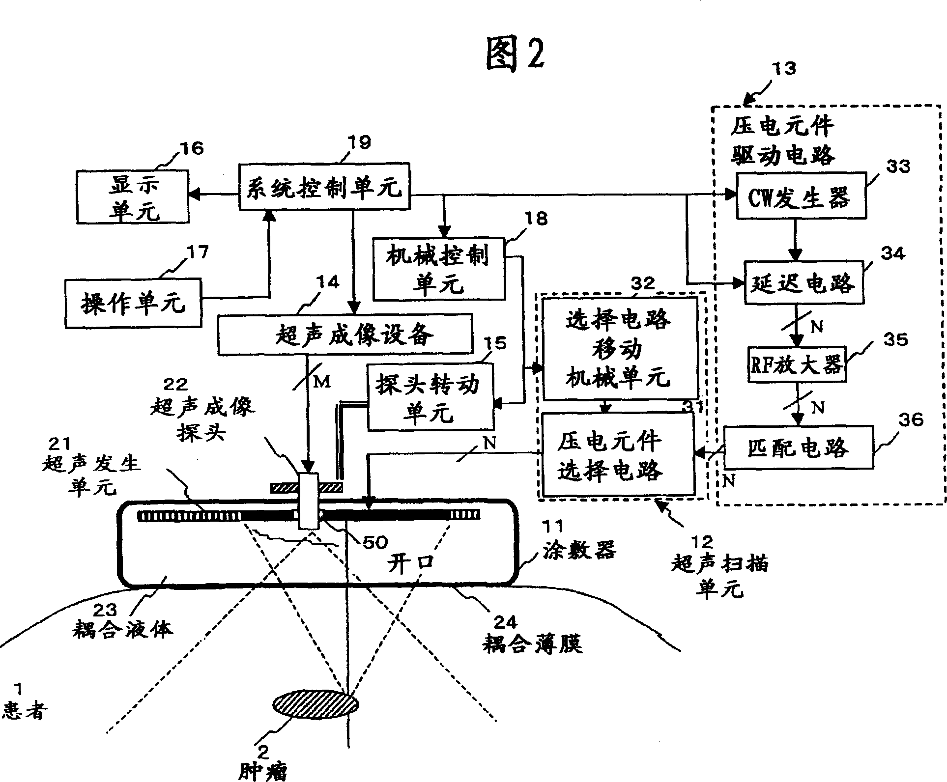 Ultrasonic radiation equipment