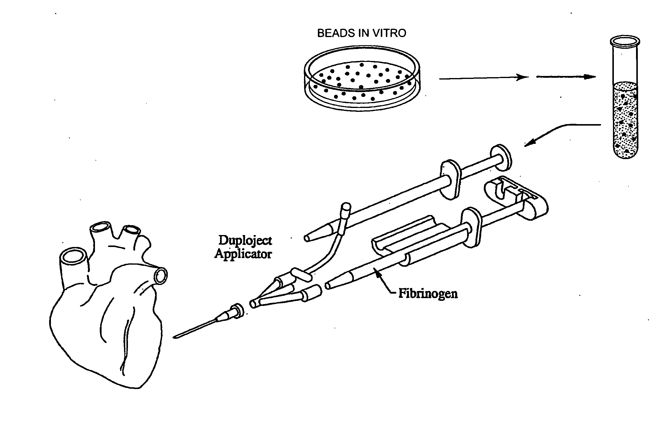 Methods and apparatus for using polymer-based beads and hydrogels for cardiac applications