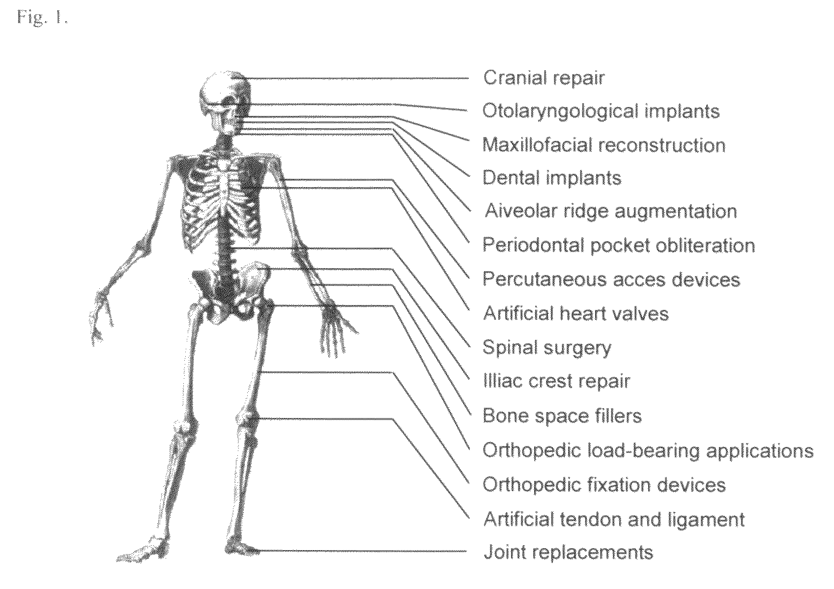 Bioactive graded zirconia-based structures