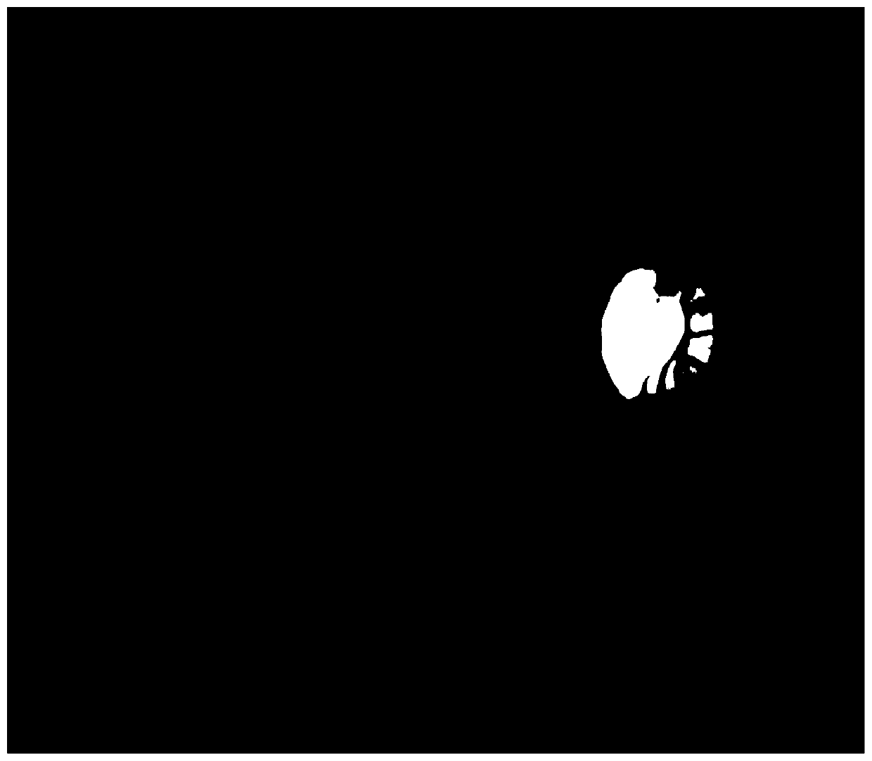 Fundus image optic disc segmentation method based on rapid mean shift