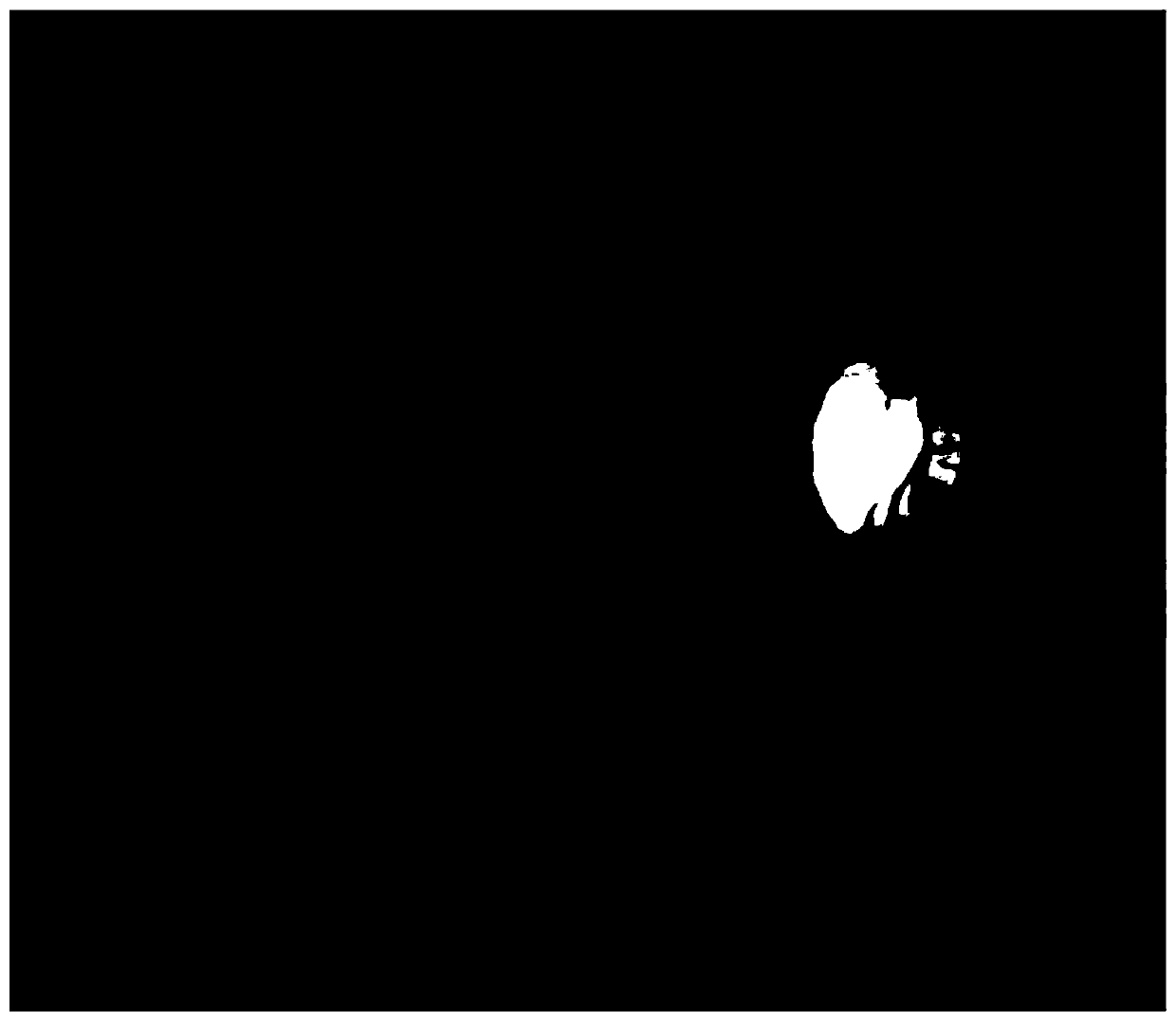 Fundus image optic disc segmentation method based on rapid mean shift