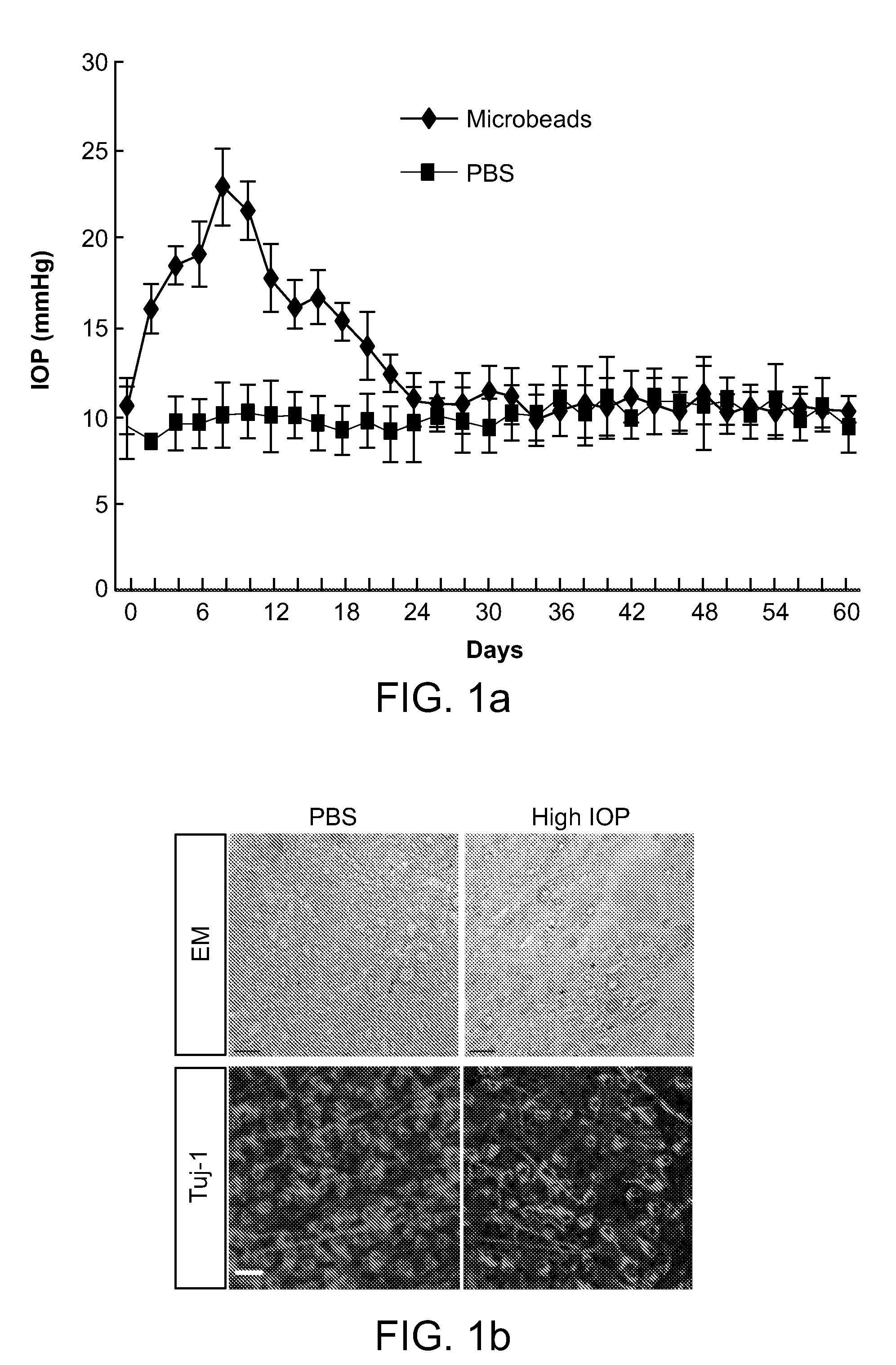 Therapies That Target Autoimmunity For Treating Glaucoma And Optic Neuropathy