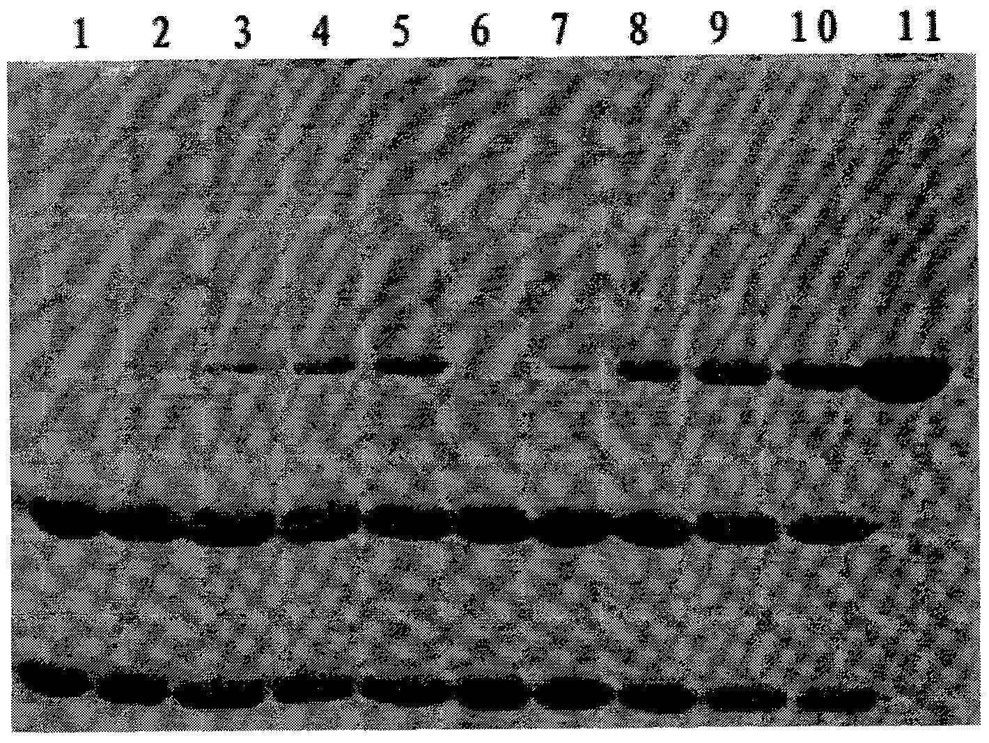 Method for preparing medicinal recombinant human interleukin-11