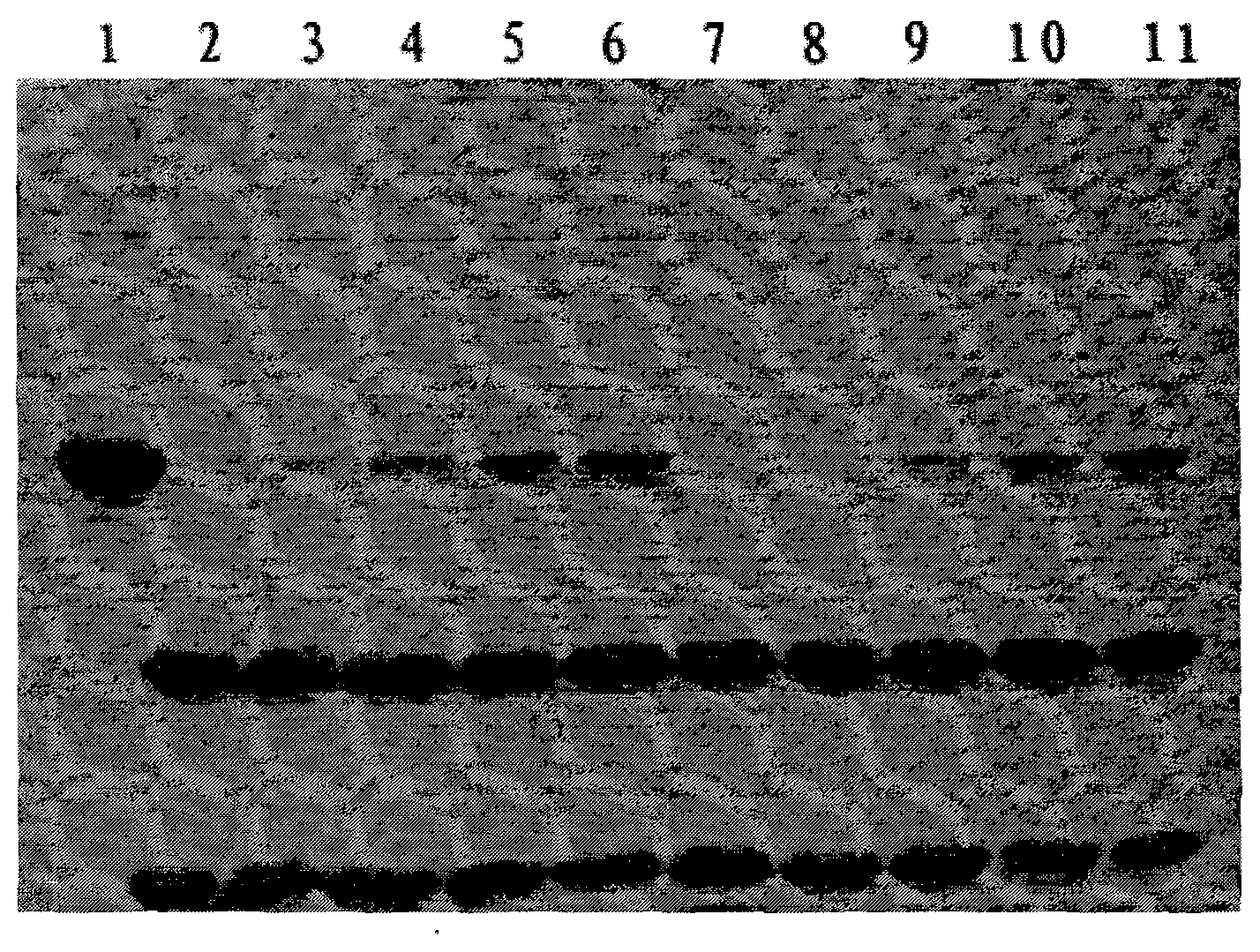 Method for preparing medicinal recombinant human interleukin-11