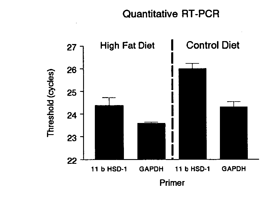 RNA interference mediated inhibition of 11beta hydroxysteriod dehydrogenase-1 (11beta HSD-1) gene expression