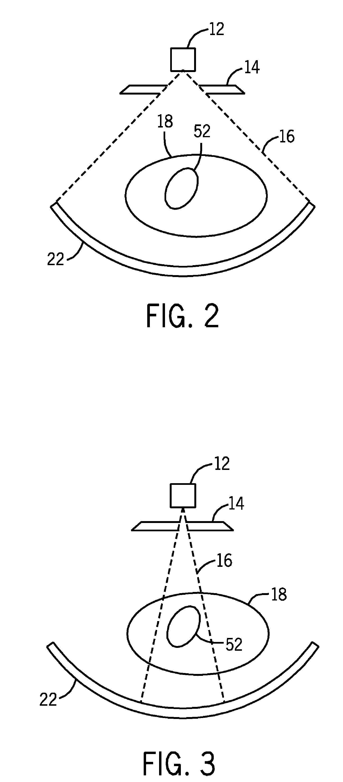 Keyhole computed tomography