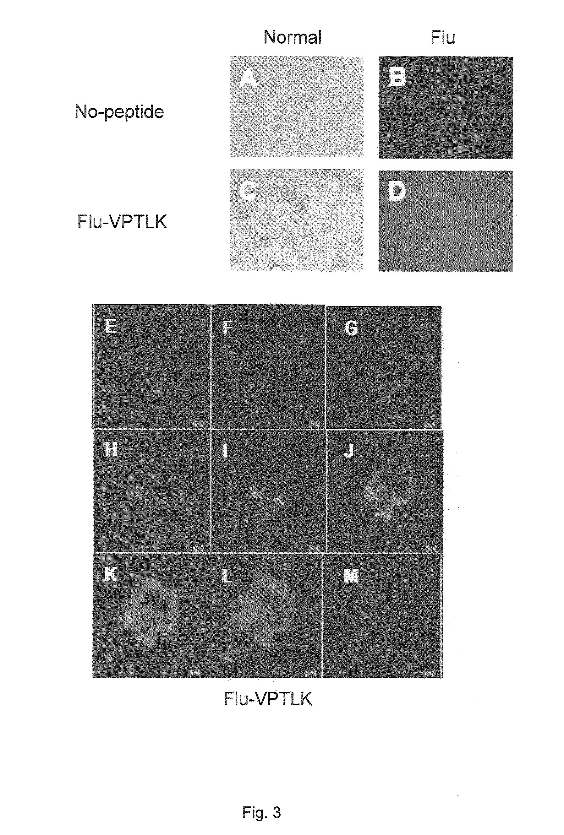 Method of treating chemotherapy-induced thrombocytopenia