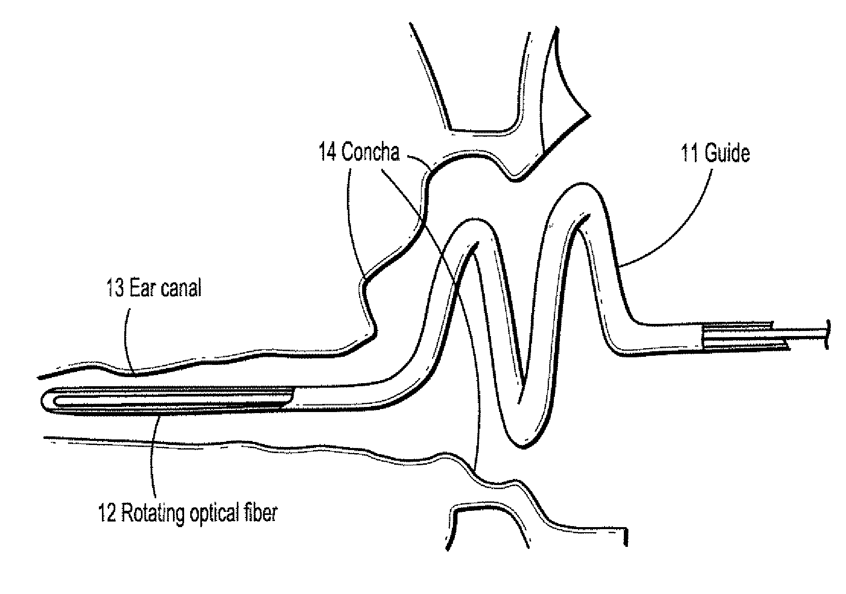 System and method for reconstruction of the human ear canal from optical coherence tomography scans