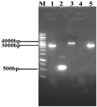 Genetically engineered bacteria with high uridine production and its construction method and application